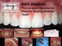2010 AAO Webinar - Non-Implant Replacement of Missing Anterior Teeth icon