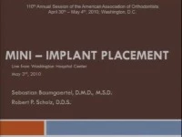 2010 Annual Session - Mini-Implant Placement - Live Clinical Procedure icon