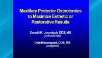 2007 - AAO Interdisciplinary Conference - Maxillary Posterior Osteotomies to Maximize Esthetic or Restorative Results icon