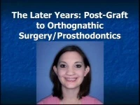 2015 AAO Annual Session - The Later Years: Post-Graft to Orthognathic Surgery/Prosthodontics / Maxillary Morphology in Cleft and Non-Cleft Subjects: A 3D Evaluation Approach icon