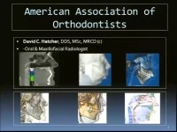 2013 Annual Session - CBCT: Identification of Anatomic Boundary Conditions Important to Orthodontists / Orthodontic Complications Seen in 3-D icon