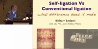 2011 NESO Annual Meeting - Self-Ligation vs. Conventional Ligation: What Difference Does It Make? icon