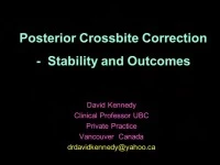 2012 Joint AAO-AAPD Conference - Stability of Posterior Cross Bite Correction icon