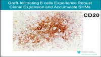 Abstract #6 - P-19: Expansion Differentiation and Selection of B Cell Clones in Rejected Kidney Grafts icon