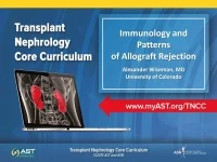 Immunology and Clinical Patterns of Allograft Rejection icon