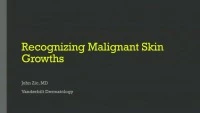Recognizing Malignant Skin Growths icon