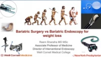 Bariatric surgery versus bariatric endoscopy for weight loss icon