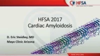 Cardiac Amyloidosis icon