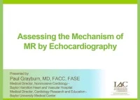 Assessing the Mechanism of MR by Echocardiography icon