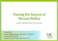 Tracing the Source of Venous Reflux icon