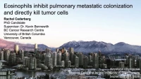 Short Talk: Eosinophils Inhibit Pulmonary Metastasis and Directly Kill Tumor Cells icon