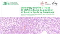 Short Talk: Immunity-Related GTPase IFGGA2 Induces Degradation of Hepatic Lipids by Lipophagy icon