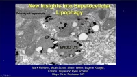 Lipid Droplet Formation and Lipophagy in Fatty Liver Disease icon