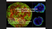 Lineage Plasticity: Lessons from Prostate Cancer icon