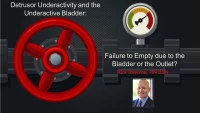 Detrusor Underactivity and the Underactive Bladder: Failure to Empty Due to the Outlet or the Bladder? icon