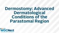 Dermostomy: Advanced Dermatological Conditions of the Parastomal Region icon