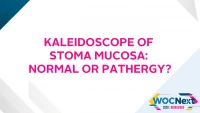 Kaleidoscope of Stoma Mucosa: Normal or Pathergy? icon