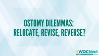 Ostomy Dilemmas: Relocate, Revise, Reverse? icon