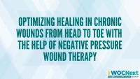 Optimizing Healing in Chronic Wounds from Head to Toe with the Help of Negative Pressure Wound Therapy icon