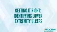 Getting it Right: Identifying Lower Extremity Ulcers icon