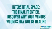 Interstitial Space: The Final Frontier. Discover Why Your Venous Wounds May Not be Healing icon