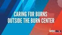 201: Caring for Burns Outside the Burn Center icon