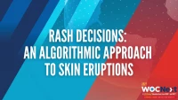 303: Rash Decisions: An Algorithmic Approach to Skin Eruptions icon