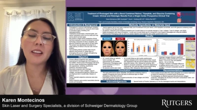 Treatment of Photoaged Skin with a Novel Combined Retinol, Tripeptide, and Glaucine Containing Cream: Clinical and Histologic Results From a Single Center Prospective Clinical Trial