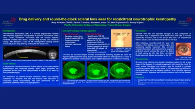 04A: Drug Delivery in Scleral Lenses for Management of Recalcitrant Neurotrophic Keratopathy