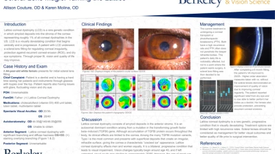 Scleral Lens Magic: Taming the Lattice