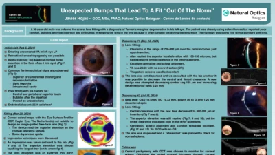 41B: Unexpected Bumps That Lead to a Fit “Out of the Norm”