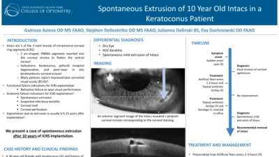 02A: Spontaneous Extrusion of 10-Year-Old INTACS In a Keratoconus Patient