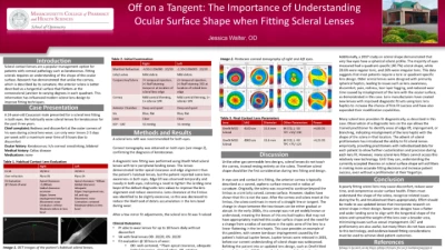 42B: Off on a Tangent: The Importance of Understanding Ocular Surface Shape When Fitting Scleral Lenses