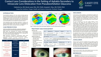 Contact Lens Considerations in the Setting of Aphakia Secondary to Intraocular Lens Dislocation from Pseudoexfoliation Glaucoma