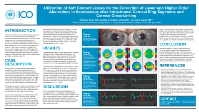 Utilization of Soft Contact Lenses for the Correction of Lower and Higher Order Aberrations in Keratoconus after Intracorneal Ring Segments and Corneal Cross-Linking