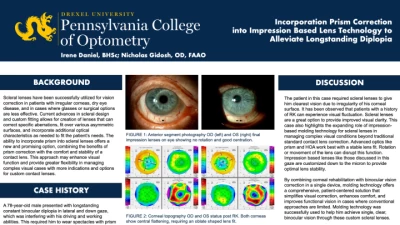 Incorporation Prism Correction into Impression Based Lens Technology to Alleviate Longstanding Diplopia