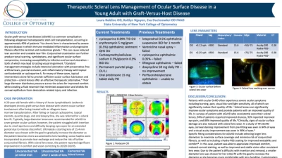 Therapeutic Scleral Lens Management of Ocular Surface Disease in a Young Adult with Graft-Versus-Host Disease