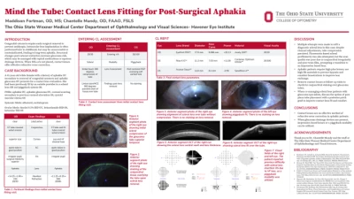 Mind the Tube: Contact Lens Fitting for Post-Surgical Aphakia