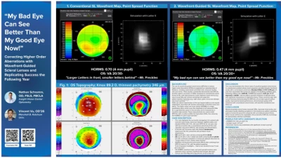 “My Bad Eye Can See Better Than My Good Eye Now!” Correcting Higher-Order Aberrations with Wavefront-Guided Scleral Lenses and Replicating Success the Following Year