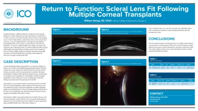 65A: Return to Function: Scleral Lens Fit Following Multiple Corneal Transplants