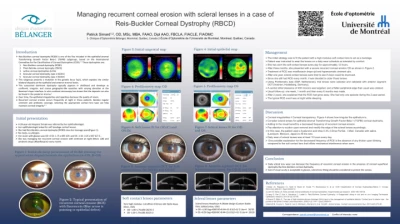 Managing recurrent corneal erosion with scleral lenses in a Reis-Bücklers Corneal Dystrophy (RBCD)