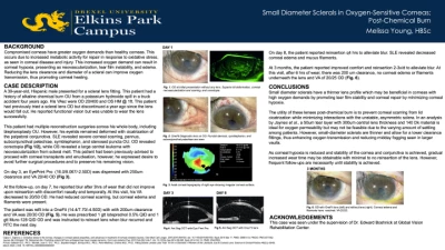 Small Diameter Sclerals in Oxygen-Sensitive Corneas: Post-Chemical Burn