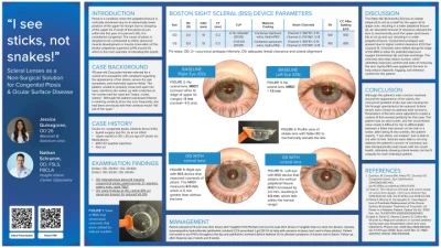 Scleral Lenses as a Non-Surgical Solution for Congenital Ptosis and Ocular Surface Disease
