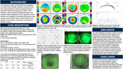 Corneal GPs Reconsidered: An Option After Scleral Lens Intolerance in Severe Post-Refractive Ectasia