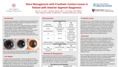 71A: Glare Management With Prosthetic Contact Lenses in Patient With Anterior Segment Dysgenesis
