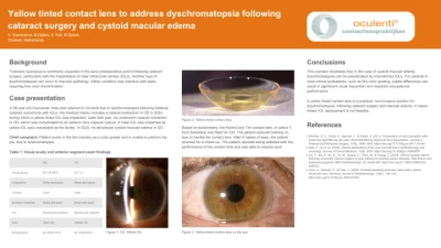 Yellow tinted contactlens to address dyschromatopsia following cataract surgery and cystoid macular edema