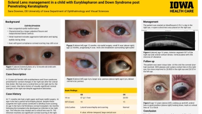 Scleral lens management in a child with Euryblepharon post Penetrating Keratoplasty