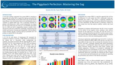 63B: The Piggy Back Perfection: Mastering the Sag
