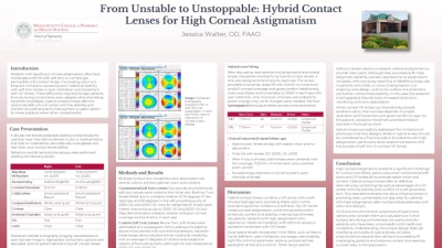 From Unstable to Unstoppable: Hybrid Lenses for High Astigmatism
