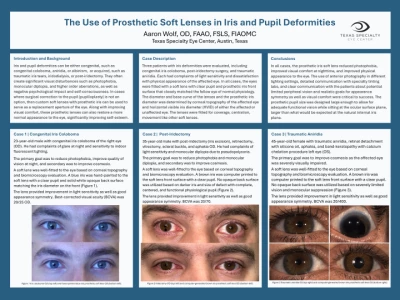 The Use of Prosthetic Soft Lenses in Iris and Pupil Deformities